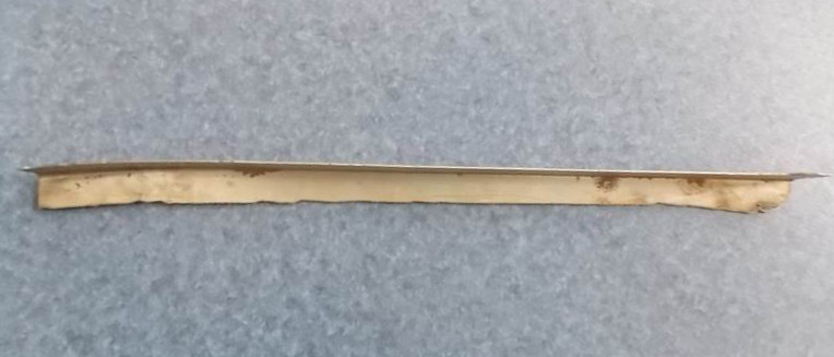 The upper and lower inner stops on the back sign-1
